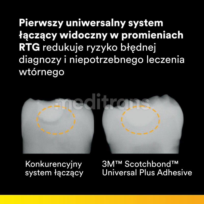 Набор Scotchbond Universal Plus, 3 шт. по 5 мл