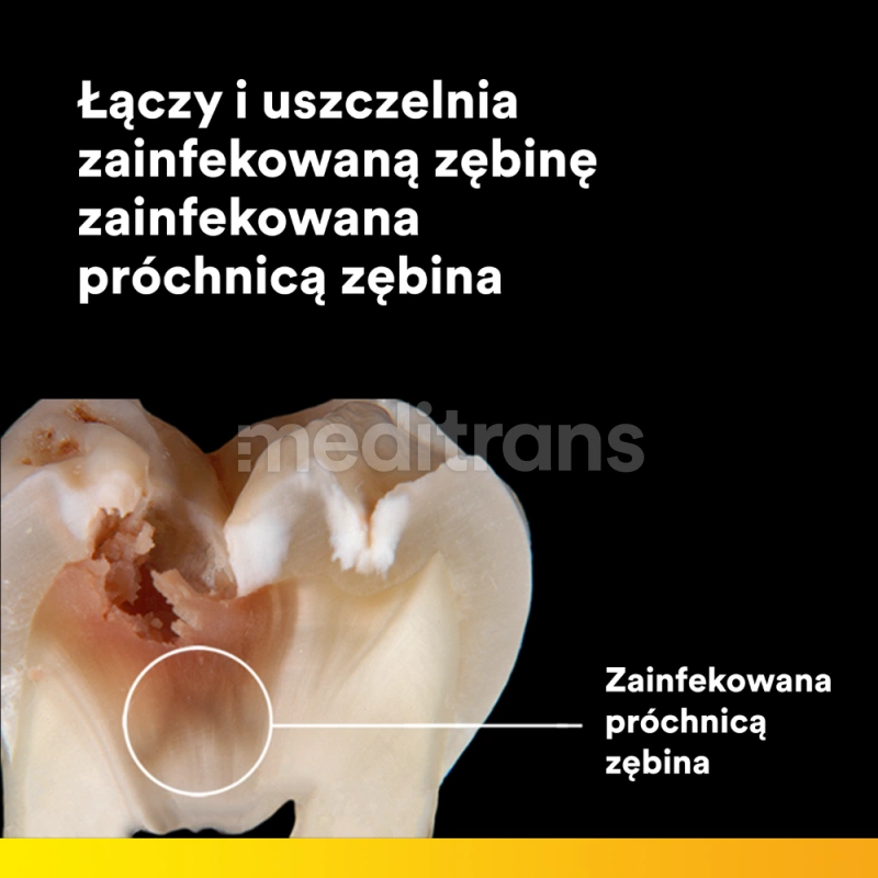 Набор Scotchbond Universal Plus, 3 шт. по 5 мл